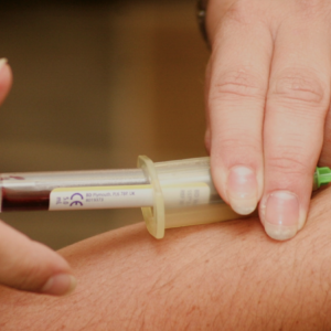 Quantiferon Gold TB (blood) Test