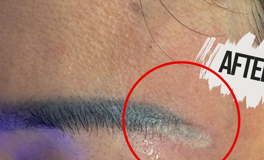 eic pmu removal after