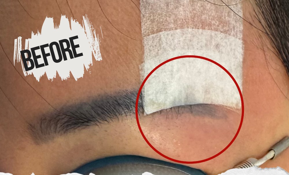 eic pmu removal before