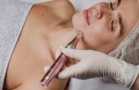 RF Microneedling with PRPPRF