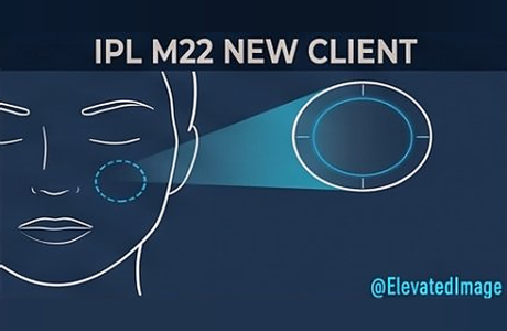 eic-16-ipl-m22-new-client-r2