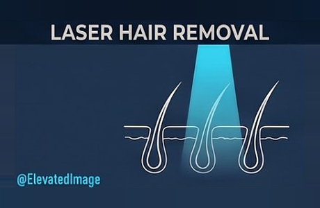 eic-20-laser-hair-removal-r2