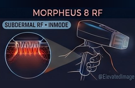 eic-v2-03-morpheus8-rf-r2